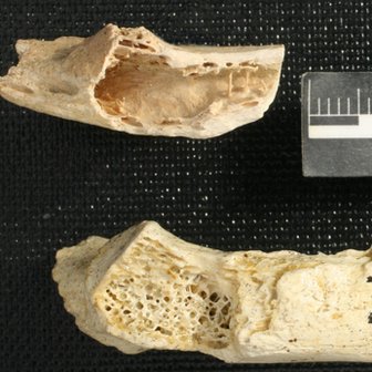 Osso anormal do Neanderthal (acima), comparado com o osso normal de outro espécime (abaixo).
